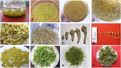 An Efficient Somatic Embryo Liquid Culture System for Potential Use in Large-Scale and Synchronic Production of Anthurium andraeanum Seedlings